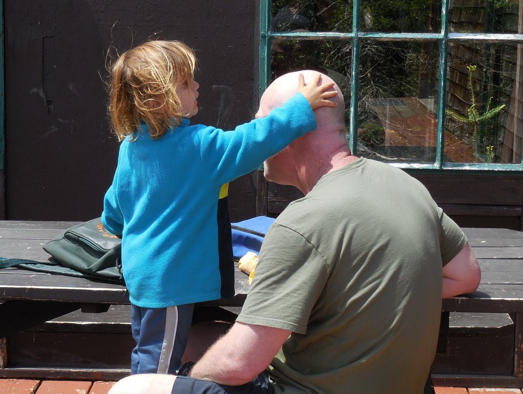 Checking out the head of a very patient man